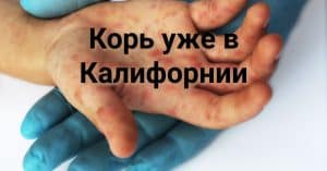 В Сакраменто произошла серия инцидентов со стрельбой. Американская блогерша оскандалилась в Австралии. В Калифорнии зафиксирована вспышка кори: власти бьют тревогу.