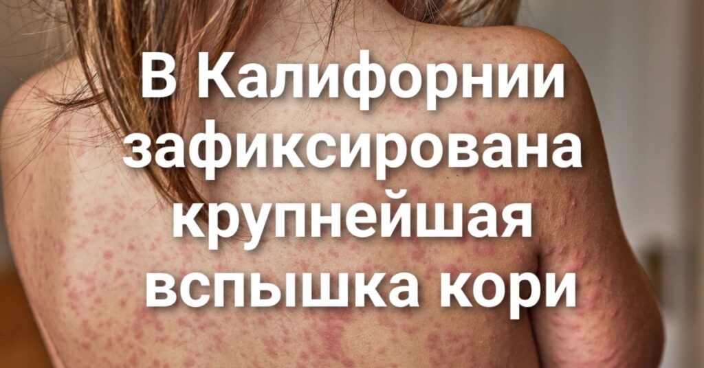 В Калифорнии зафиксирована крупнейшая вспышка кори за последние пять лет. В Truckee водитель въехал в группу детей-спортсменов. В Калифорнии могут ввести уголовную ответственность за «кражу» ДНК. В Калифорнии зафиксирована крупнейшая вспышка кори за последние пять лет. В Truckee водитель въехал в группу детей-спортсменов. В Калифорнии могут ввести уголовную ответственность за «кражу» ДНК.