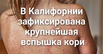 В Калифорнии зафиксирована крупнейшая вспышка кори за последние пять лет. В Truckee водитель въехал в группу детей-спортсменов. В Калифорнии могут ввести уголовную ответственность за «кражу» ДНК.