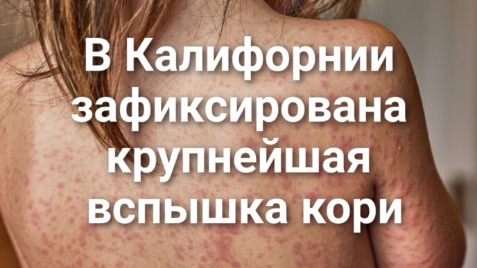 В Калифорнии зафиксирована крупнейшая вспышка кори за последние пять лет. В Truckee водитель въехал в группу детей-спортсменов. В Калифорнии могут ввести уголовную ответственность за «кражу» ДНК.